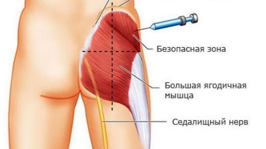 Как нужно делать инъекции? Сохраните себе и, возможно, это спасёт кому-то жизнь!
