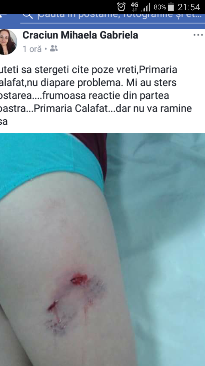 ȘOC la Calafat! Mușcat de câinii vagabonzi în centrul orașului! Nulitatea locală nu reacționează! Rușine! - RealitateaDunareana.ro