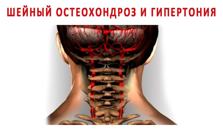 Сегодня собственная шея убивает втрое больше людей, чем онкология
