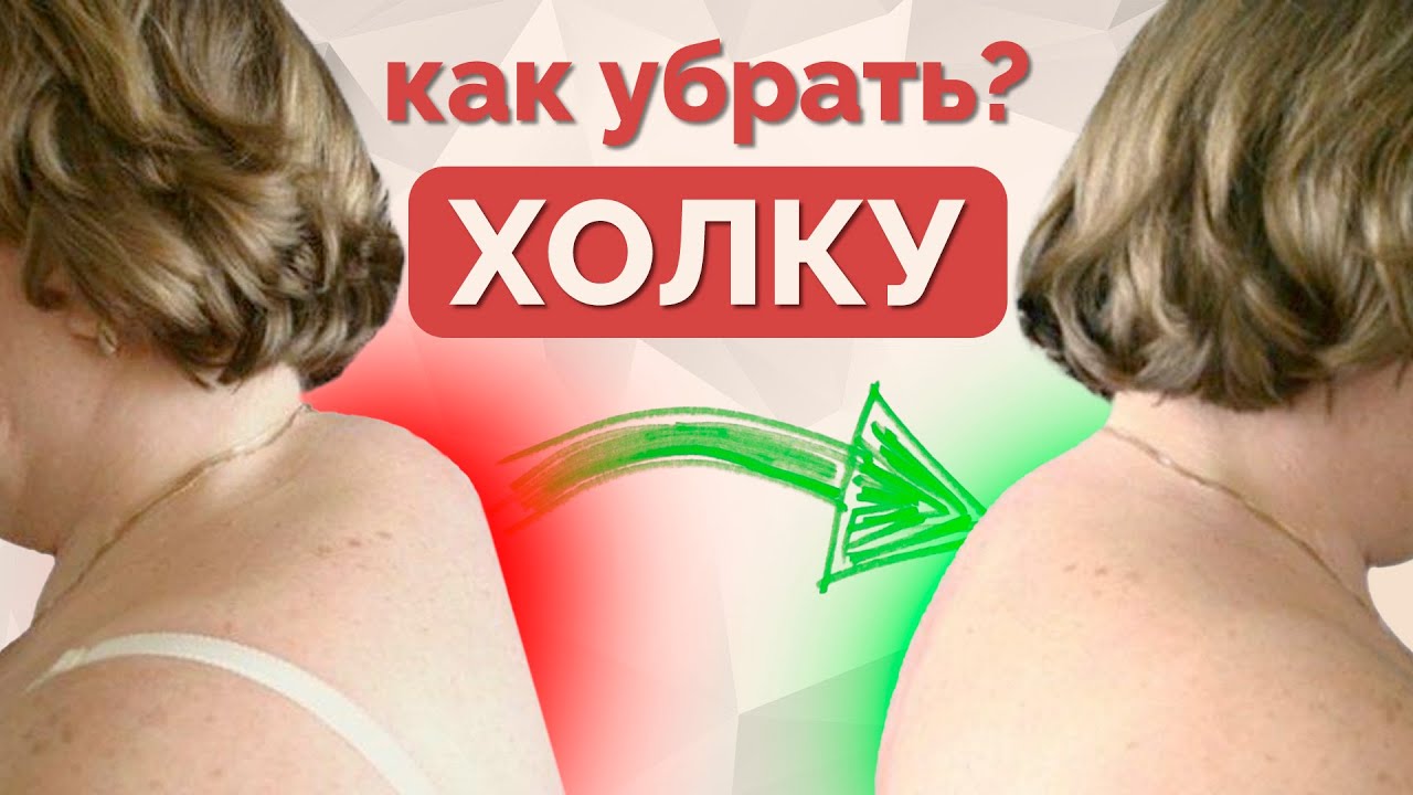 Как убрать вдовий горб? Упражнения от холки. - YouTube